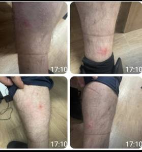 UPDATE - Sindicatul Europol: Poliţişti muşcaţi de ploşniţe în sediile Poliţiei Capitalei – Zece persoane au ajuns la Urgenţă / Peste 40% dintre angajaţi vor să plece din aceste structuri / Sesizare la DSP şi Avocatul Poporului / Reacţia Poliţiei - FOTO
