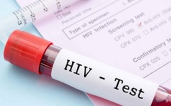 Cei mai mulţi pacienţi români infectaţi cu HIV afirmă că au mari reţineri atunci când sunt puşi în situaţia de a discuta cu alte persoane despre afecţiunea lor/ Aproape jumătate spun că există foarte multă stigmatizare cu privire la persoanele cu HIV 