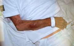 Mărturii cutremurătoare despre pacienţii exploataţi de reţeaua din Bihor - Pacient cu traumatism cranian vechi de trei zile, fără asistenţă medicală. Medicul şef UPU SMURD Bihor: Pe unii îi abandonau în gara din Oradea sau în UPU ca să scape de ei