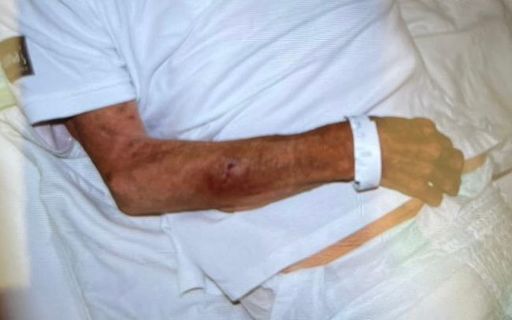 Mărturii cutremurătoare despre pacienţii exploataţi de reţeaua din Bihor - Pacient cu traumatism cranian vechi de trei zile, fără asistenţă medicală. Medicul şef UPU SMURD Bihor: Pe unii îi abandonau în gara din Oradea sau în UPU ca să scape de ei