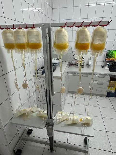 Centrul de Transfuzie Sanguină Bucureşti introduce un nou component sanguin – amestec (pool) de concentrate trombocitare deleucocitat