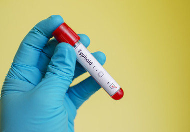 Un studiu a identificat această substanţă în urina femeilor cu endometrioză