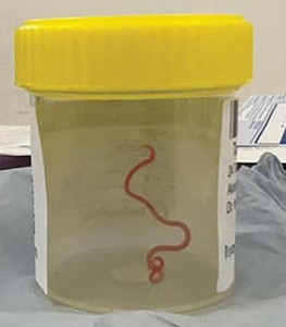Descoperire în premieră: Un vierme care parazitează şerpii găsit viu în creierul unei femei din Australia