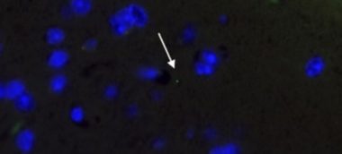 Microplasticele se pot infiltra în toate organele, inclusiv în creier, indică un studiu preclinic