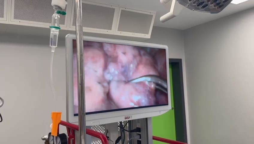 Premieră medicală la Spitalul Judeţean Bistriţa-Năsăud: Chirurgie toracică minim invazivă, fără intubaţie