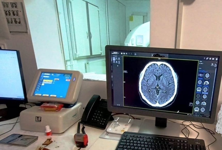 Aproape 50 de pacienţi cu accident vascular cerebral ischemic au beneficiat de tromboliză la Spitalul Judeţean de Urgenţă Târgu Jiu, de la începutul anului / Unii dintre ei au recuperat integral deficitul neurologic