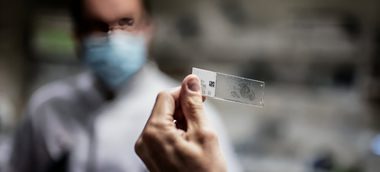 AI în căutarea „secretului” persoanelor care supravieţuiesc celor mai mortale cancere