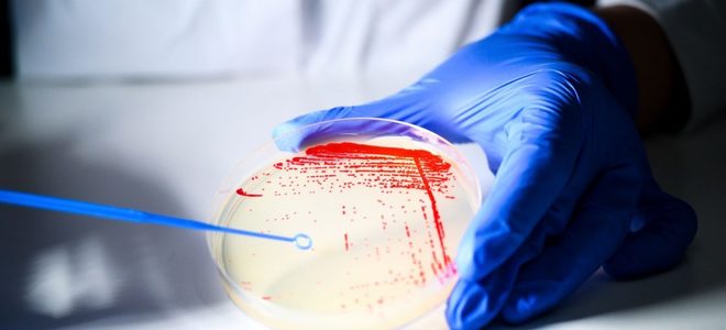 O singură doză dintr-o nouă clasă de antibiotice a eliminat infecţiile rezistente din sânge, în testele preclinice