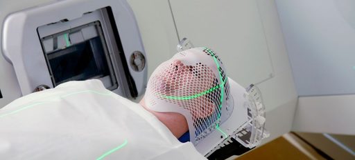 Oamenii de ştiinţă au descoperit o ţintă promiţătoare de tratament pentru cancerul cerebral rezistent