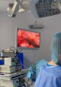 Intervenţie în premieră la Spitalul Clinic Judeţean de Urgenţă Sibiu, la un pacient oncologic - amputaţie de rect prin abordare laparoscopică