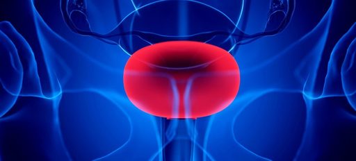 Un medicament experimental pentru cancerul vezicii urinare a obţinut rezultate pozitive într-un studiu clinic