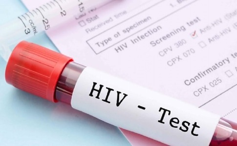 Descoperire majoră în căutarea unui tratament pentru HIV: cercetătorii australieni au reuşit să expună virusul ascuns în celule

