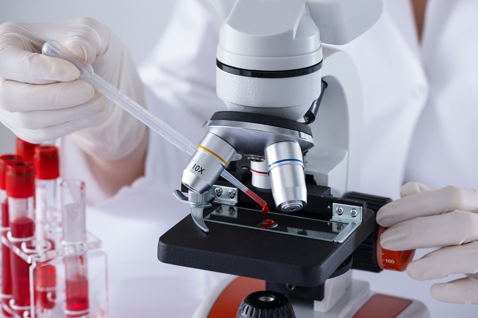 O singură mutaţie genetică ar fi putut face ca oamenii să fie mai vulnerabili la cancer decât primatele