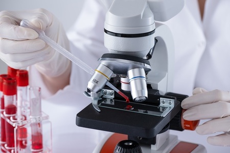 O singură mutaţie genetică ar fi putut face ca oamenii să fie mai vulnerabili la cancer decât primatele
