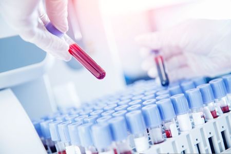 O terapie experimentală pentru o afecţiune precanceroasă a sângelui a generat un răspuns de 100%, potrivit rezultatelor prezentate la reuniunea anuală a Societăţii Internaţionale pentru Mielom