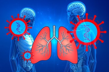 De ce revin uneori infecţiile pulmonare chiar şi după luni de tratament?