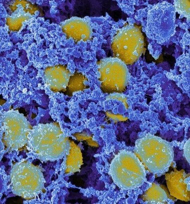 Virusurile ar putea deveni o nouă armă împotriva infecţiilor bacteriene rezistente la antibiotice