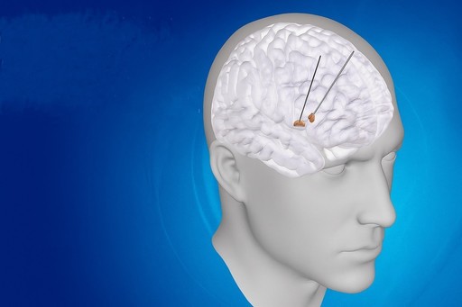 O nouă boală genetică rară care afectează creierul, identificată de oamenii de ştiinţă