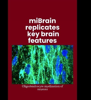 Ţesuturi cerebrale create în laborator, care reproduc toate tipurile majore de celule, ar putea accelera cercetarea în terapiile neurologice
