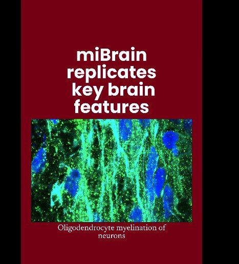 Ţesuturi cerebrale create în laborator, care reproduc toate tipurile majore de celule, ar putea accelera cercetarea în terapiile neurologice
