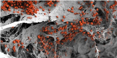 Premieră în biomedicină: Cercetătorii au creat în laborator o măduvă osoasă umană funcţională
