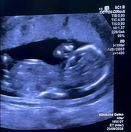 O femeie însărcinată, forţată să se deplaseze în Germania pentru tratament, după ce a trecut printr-o situaţie ”halucinantă” la Spitalul Filantropia din Bucureşti / Ce acuzaţii se aduc - FOTO / VIDEO 

