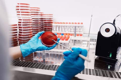 Încălzirea globală accelerează rezistenţa la antibiotice, indică un studiu interaţional