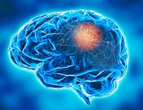 Ar putea celulele imunitare din creier să distrugă neuronii în scleroza laterală amiotrofică?
