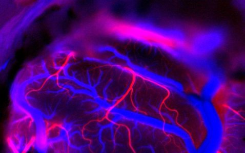 Neuralink, compania lui Elon Musk, va testa implanturi cerebrale pentru persoane cu tulburări de vorbire
