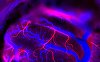 Neuralink, compania lui Elon Musk, va testa implanturi cerebrale pentru persoane cu tulburări de vorbire