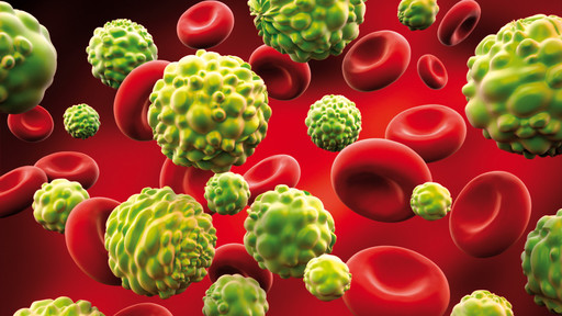 Inteligenţa artificială poate depista cancerul la colon cu mare precizie