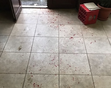 Patronul unei terase din Mamaia a încercat să împiedice un control al OPC şi şi-a spart un pahar în cap, ajungând la spital - FOTO, VIDEO