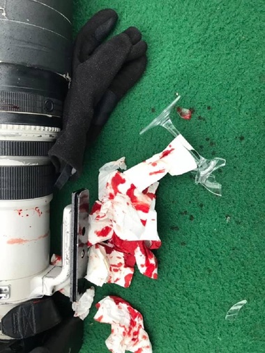 Bărbat aflat într-o ambarcaţiune în Delta Dunării, rănit de un altul, aflat într-o altă barcă, supărat că i s-a reproşat că mergea cu viteză/ Bărbatul agresat: Încă domneşte legea lui -”Bă, tu ştii cine sunt eu?”
