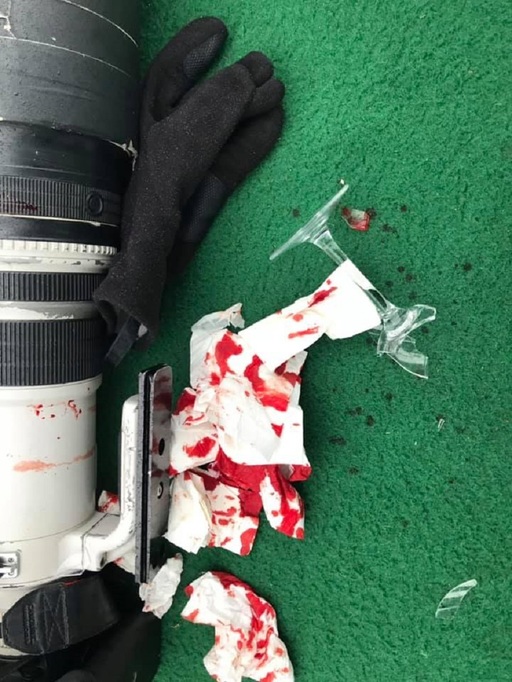 Bărbat aflat într-o ambarcaţiune în Delta Dunării, rănit de un altul, aflat într-o altă barcă, supărat că i s-a reproşat că mergea cu viteză/ Bărbatul agresat: Încă domneşte legea lui -”Bă, tu ştii cine sunt eu?”