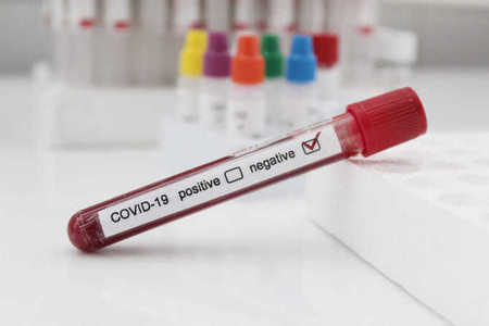 Patru cetăţeni ucrainieni, prinşi la intrarea în ţară cu teste negative de coronavirus false  