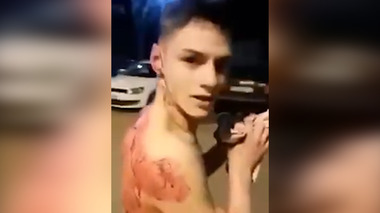Timişoara: Tânăr atacat cu cuţitul pe stradă, din cauza unei fete / Agresorul a fost arestat preventiv