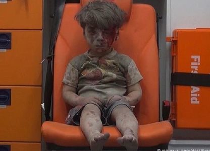 Rusia se declară de acord cu un armistiţiu săptămânal la Alep, după ce imagini cu Omran au devenit virale pe Internet