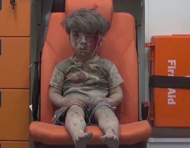 Fratele lui Omran, Ali, în vârstă de zece ani, a murit din cauza rănilor într-un spital din Alep