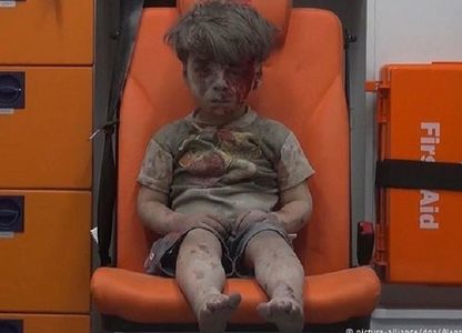 Al-Assad afirmă că imaginea cu Omran Daqneesh în ambulanţă este falsă