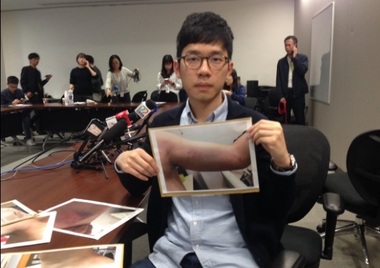 Un parlamentar pro-democraţie atacat de protestatarii anti-independenţă pe aeroportul din Hong Kong