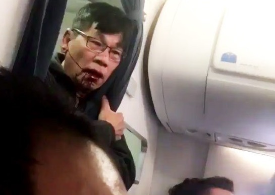 SUA: Avocatul lui David Dao anunţă că acesta ar putea să dea în judecată United Airlines 