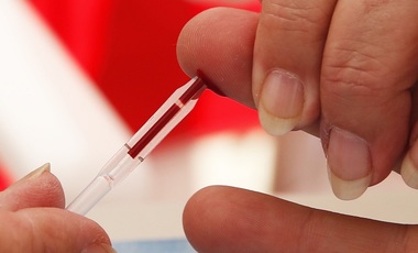 Situaţia epidemiei de HIV în rândul tinerilor homosexuali din Franţa, ”extrem de îngrijorătoare” - studiu