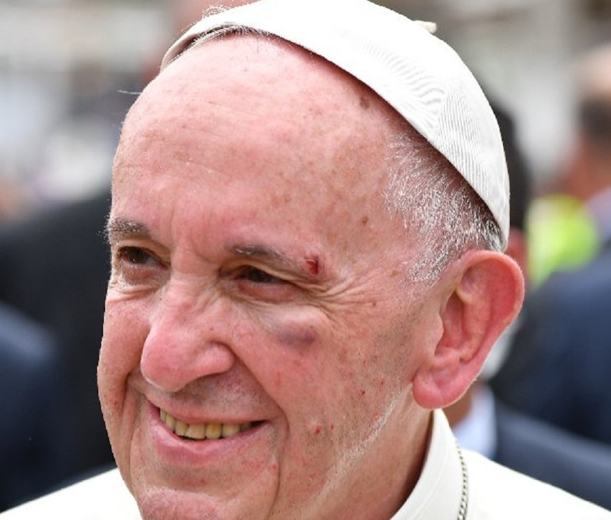 Papa Francisc s-a rănit în ultima etapă a turneului său în Columbia, în timp ce mergea cu papamobilul. VIDEO