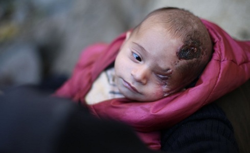 #SolidarityWithKarim: Un bebeluş sirian care şi-a pierdut un ochi într-un bombardament al regimului devine un simbol pe Internet