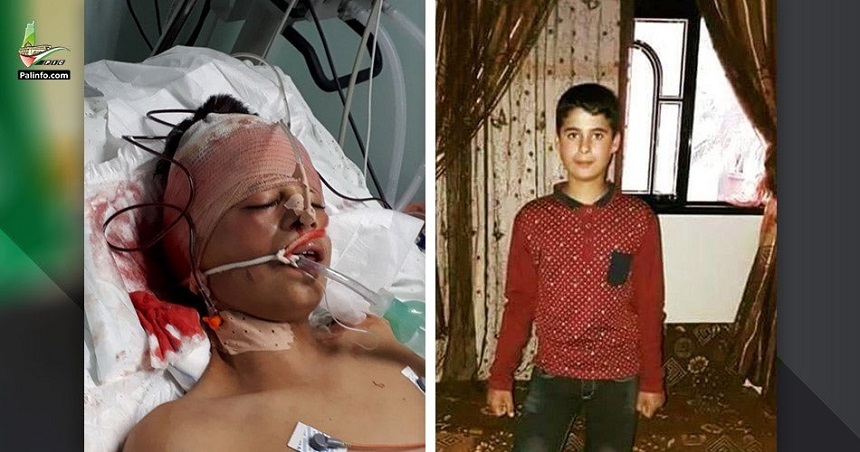 Un adolescent palestinian, împuşcat în cap de armata israeliană la ”marele marş al întoarcerii”, moare; bilanţul victimelor ajunge la 45