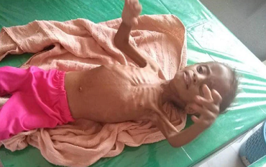 Aproximativ 85.000 de copii morţi de foame sau din cauza bolii în Yemen, estimează Save the Children