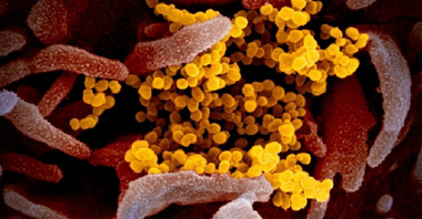 Bilanţul morţilor creşte în Spania cu 394 la 1.720 şi cu 3.646 de contaminări cu noul coronavirus la 28.572 de cazuri