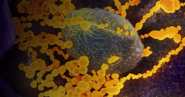 Coronavirus: Mai mult de 60.000 de cazuri oficial declarate în Statele Unite; 827 de decese