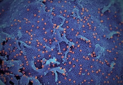 Coronavirus - 14.967 de decese în Franţa de la începutul epidemiei 