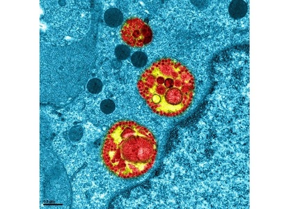 Coronavirus: 1.251 de noi cazuri de contaminare în Germania